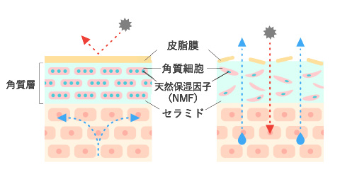 敏感肌ケア